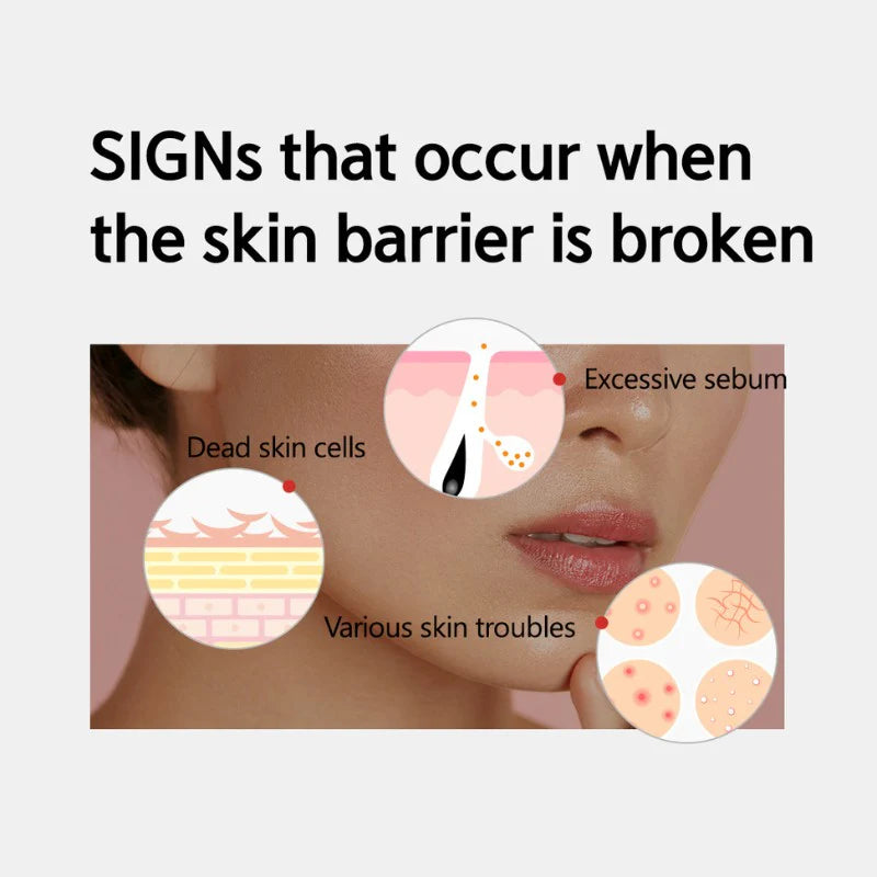 Origin Red Salicylic Acid Spot Cream