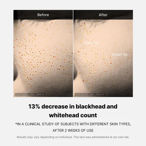 Zero Pore One-day Serum